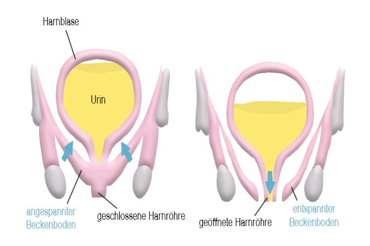 Entzündung beckenboden ISG