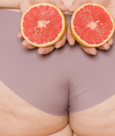 Rectocèle, comment régler le problème ?