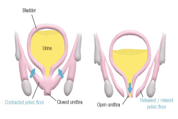 pelvic floor dysfunction. the sphincter is not working correctly