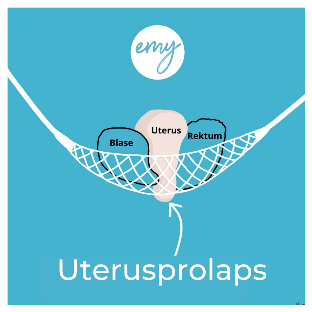 Gebärmuttervorfall Beckenboden Anatomie einfach erklärt