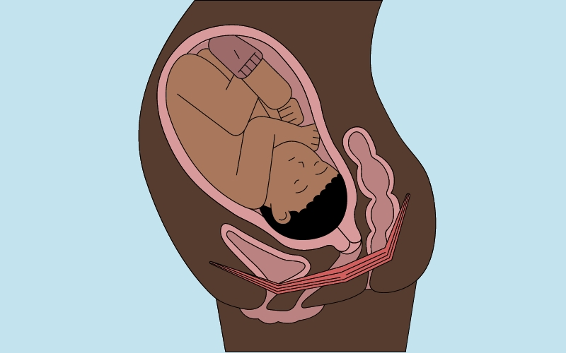 Beckenboden Anatomie Frau Schwangerschaft