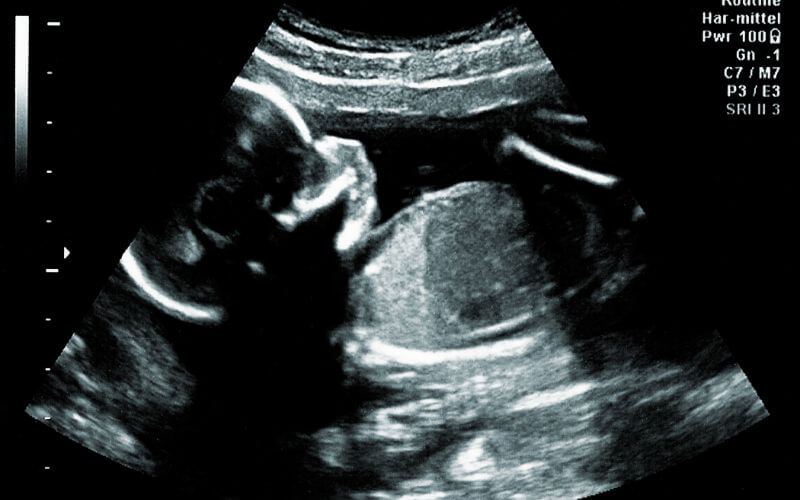 bébé qui bouge dans le ventre